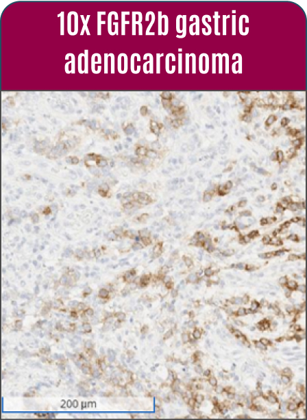 10x-fgfr2b-mob