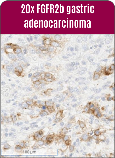 20x-fgfr2b-mob