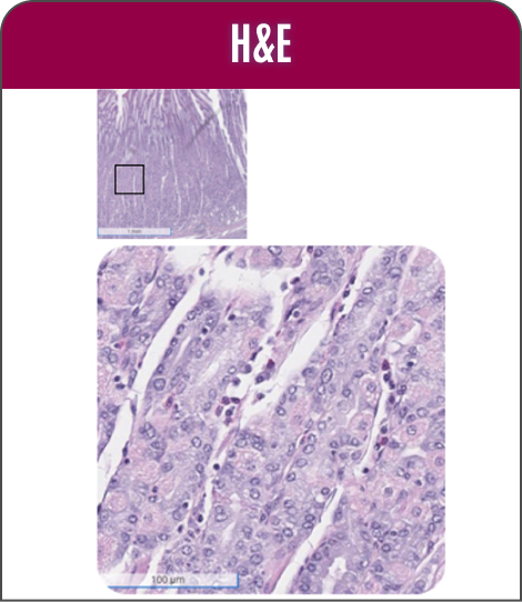 Chief H&E cells adjacent to normal cells